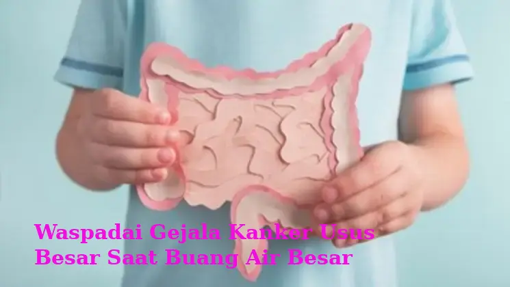 Waspadai Gejala Kanker Usus Besar Saat Buang Air Besar